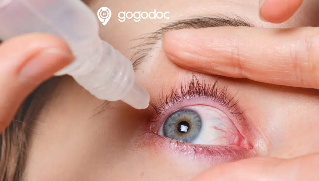 Dry eyes: Causes, Symptoms, and Treatments