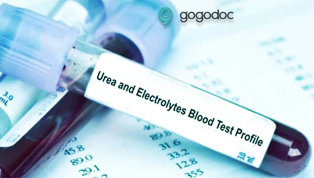 Urea and Electrolytes Test