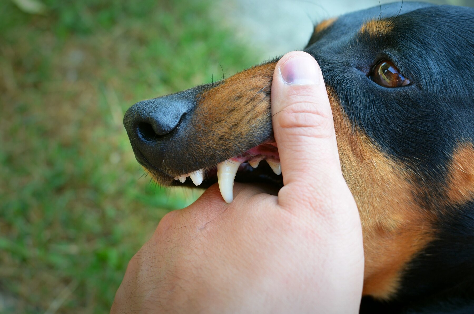 Read more about the article Dog Bites: Symptoms, Prevention, and Treatments